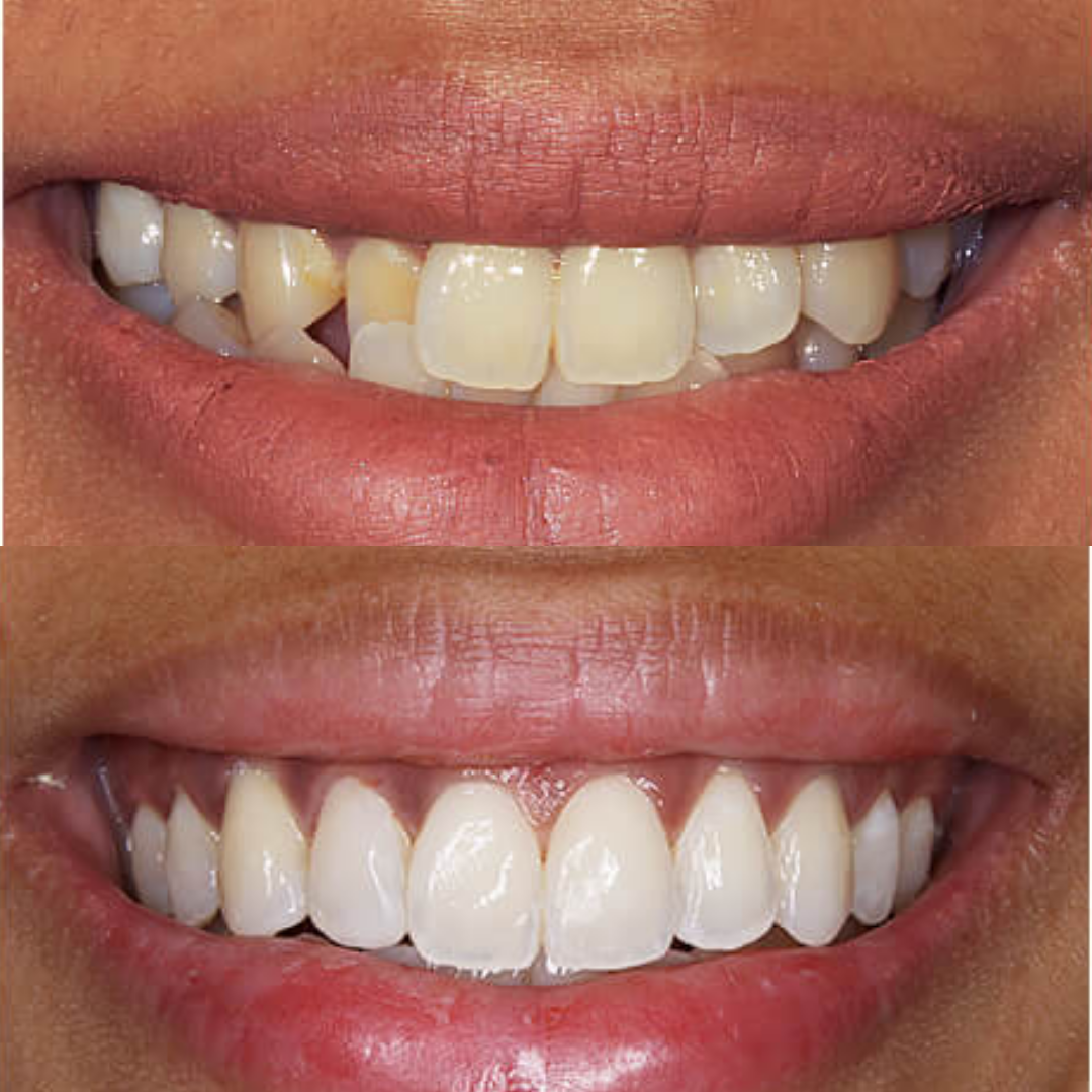 First finished Cosmetic & Laser Dentistry Centre image ad